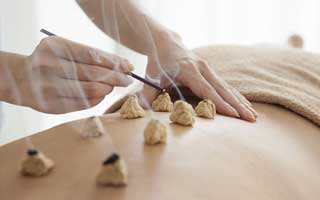 Moxibustion